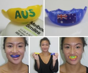 Uyen 2 mouthguards